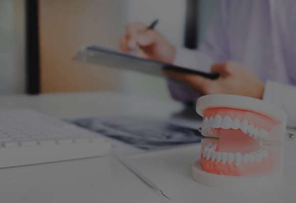 Conheça os melhores modelos de implante dentário