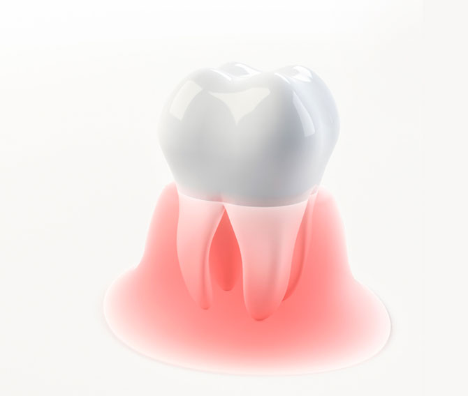Os tipos de ortodontia